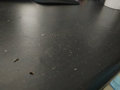 Hair dandruff dirt on the table. Dandruff Problem. Closed up. photo