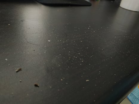 Hair dandruff dirt on the table. Dandruff Problem. Closed up. photo