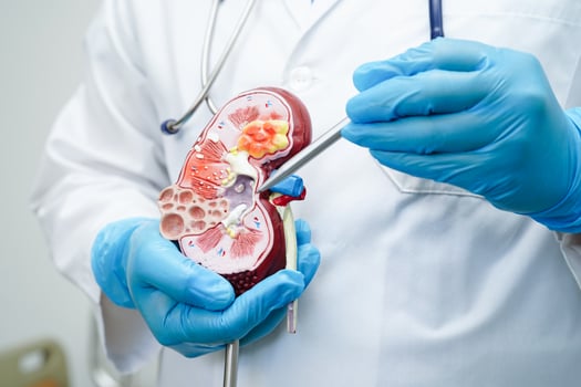 Chronic kidney disease, doctor with model for treatment urinary system, urology, Estimated glomerular filtration rate eGFR. photo