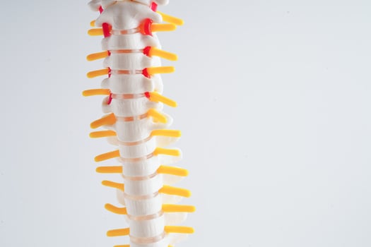 Spinal nerve and bone, Lumbar spine displaced herniated disc fragment, Model for treatment medical in the orthopedic department. photo