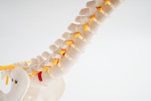 Spinal nerve and bone, Lumbar spine displaced herniated disc fragment, Model for treatment medical in the orthopedic department. photo