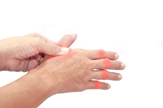 Woman finger suffering from knuckle pain on white background. Healthcare and office syndrome concept. photo