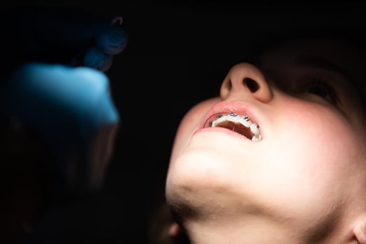 Close up of girl with brackets receiving dental braces treatment in clinic photo