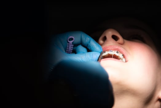 Close up of girl with brackets receiving dental braces treatment in clinic photo