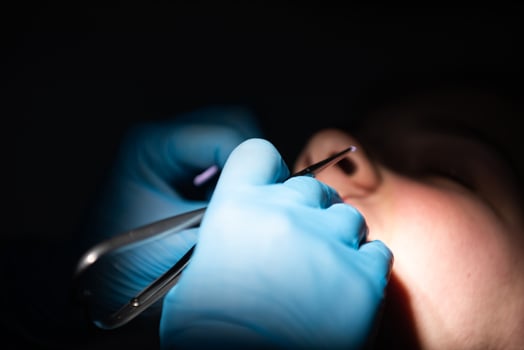 Close up of girl with brackets receiving dental braces treatment in clinic photo
