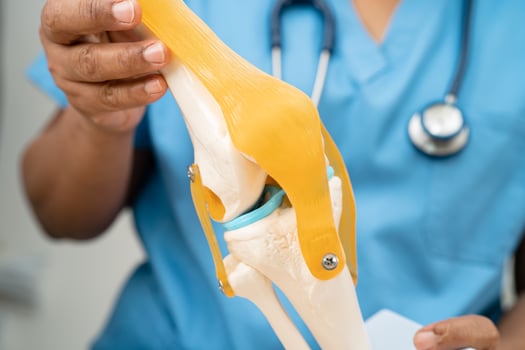 Osteoarthritis of the knee, Doctor holding human knee joint orthopedic anatomy model in hospital. photo