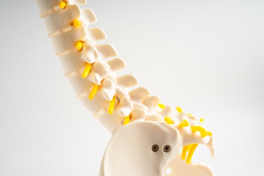 Lumbar spine displaced herniated disc fragment, spinal nerve and bone. Model for treatment medical in the orthopedic department. photo