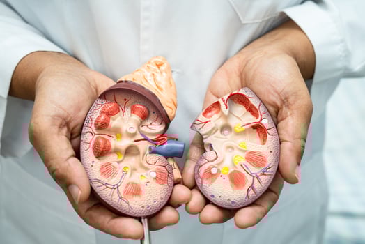Kidney disease, Chronic kidney disease ckd, Doctor with human model to study and treat in hospital. photo