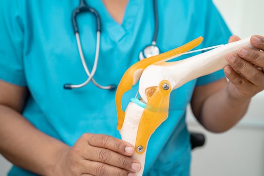 Osteoarthritis of the knee, Doctor holding human knee joint orthopedic anatomy model in hospital. photo