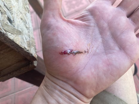 Wound cut on hand from wire photo