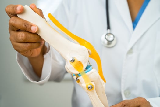 Osteoarthritis of the knee, Doctor holding human knee joint orthopedic anatomy model in hospital. photo