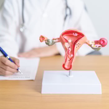 Doctor with Uterus and Ovaries anatomy model. Ovarian and Cervical cancer, Cervix disorder, Endometriosis, Hysterectomy, Uterine fibroids, Reproductive system, Pregnancy and health concept photo
