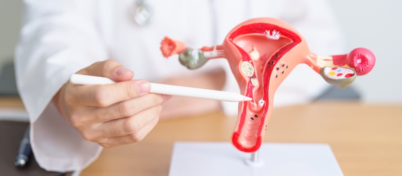 Doctor with Uterus and Ovaries anatomy model. Ovarian and Cervical cancer, Cervix disorder, Endometriosis, Hysterectomy, Uterine fibroids, Reproductive system, Pregnancy and health concept photo