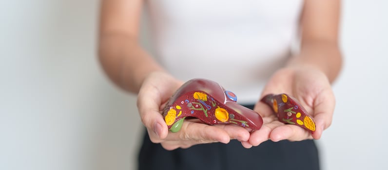 Woman holding human Liver anatomy model. Liver cancer and Tumor, Jaundice, Viral Hepatitis A, B, C, D, E, Cirrhosis, Failure, Enlarged, Hepatic Encephalopathy, Ascites Fluid in Belly and health photo