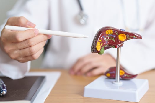 Doctor with human Liver anatomy model. Liver cancer and Tumor, Jaundice, Viral Hepatitis A, B, C, D, E, Cirrhosis, Failure, Enlarged, Hepatic Encephalopathy, Ascites Fluid in Belly and health concept photo