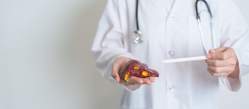 Doctor holding human Liver anatomy model. Liver cancer and Tumor, Jaundice, Viral Hepatitis A, B, C, D, E, Cirrhosis, Failure, Enlarged, Hepatic Encephalopathy, Ascites Fluid in Belly and health photo