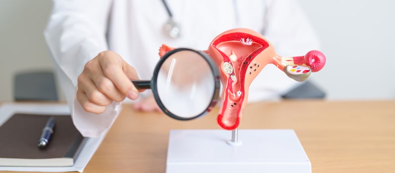 Doctor with Uterus and Ovaries anatomy model and magnifying glass. Ovarian and Cervical cancer, Cervix disorder, Endometriosis, Hysterectomy, Uterine fibroids, Reproductive system, Pregnancy photo
