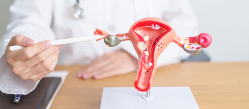 Doctor with Uterus and Ovaries anatomy model. Ovarian and Cervical cancer, Cervix disorder, Endometriosis, Hysterectomy, Uterine fibroids, Reproductive system, Pregnancy and health concept photo