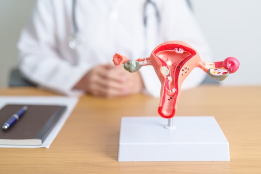 Doctor with Uterus and Ovaries anatomy model. Ovarian and Cervical cancer, Cervix disorder, Endometriosis, Hysterectomy, Uterine fibroids, Reproductive system, Pregnancy and health concept photo