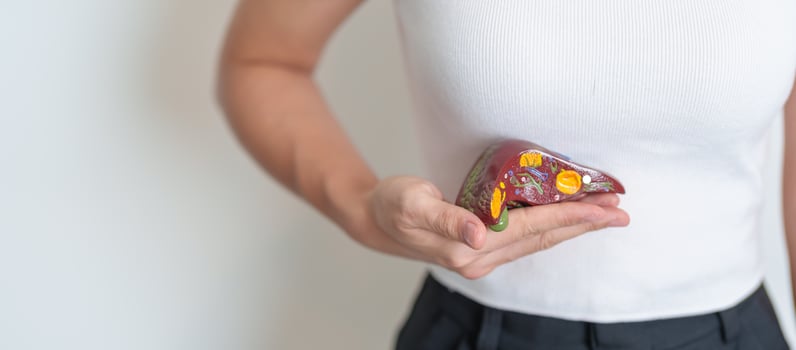 Woman holding human Liver anatomy model. Liver cancer and Tumor, Jaundice, Viral Hepatitis A, B, C, D, E, Cirrhosis, Failure, Enlarged, Hepatic Encephalopathy, Ascites Fluid in Belly and health photo