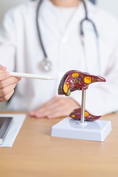 Doctor with human Liver anatomy model. Liver cancer and Tumor, Jaundice, Viral Hepatitis A, B, C, D, E, Cirrhosis, Failure, Enlarged, Hepatic Encephalopathy, Ascites Fluid in Belly and health concept photo