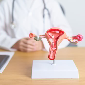 Doctor with Uterus and Ovaries anatomy model. Ovarian and Cervical cancer, Cervix disorder, Endometriosis, Hysterectomy, Uterine fibroids, Reproductive system, Pregnancy and health concept photo
