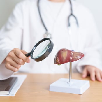 Doctor with human Liver model and Magnifying glass. Liver cancer and Tumor, Jaundice, Viral Hepatitis A, B, C, D, E, Cirrhosis, Failure, Enlarged, Hepatic Encephalopathy and Ascites Fluid in Belly photo