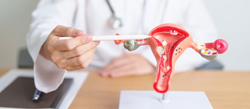 Doctor with Uterus and Ovaries anatomy model. Ovarian and Cervical cancer, Cervix disorder, Endometriosis, Hysterectomy, Uterine fibroids, Reproductive system, Pregnancy and health concept photo