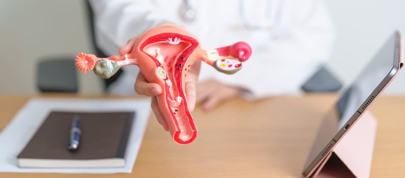 Doctor with Uterus and Ovaries anatomy model and tablet. Ovarian and Cervical cancer, Cervix disorder, Endometriosis, Hysterectomy, Uterine fibroids, Reproductive system, Pregnancy photo