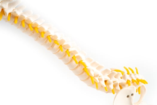 Lumbar spine displaced herniated disc fragment, spinal nerve and bone. Model for treatment medical in the orthopedic department. photo