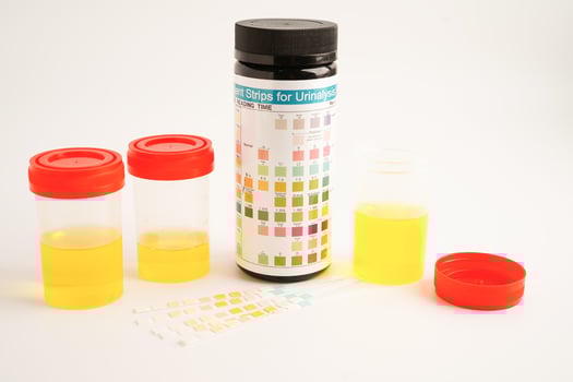 Urinalysis, urine cup with reagent strip pH paper test and comparison chart in laboratory. photo