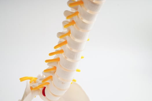 Spinal nerve and bone, Lumbar spine displaced herniated disc fragment, Model for treatment medical in the orthopedic department. photo