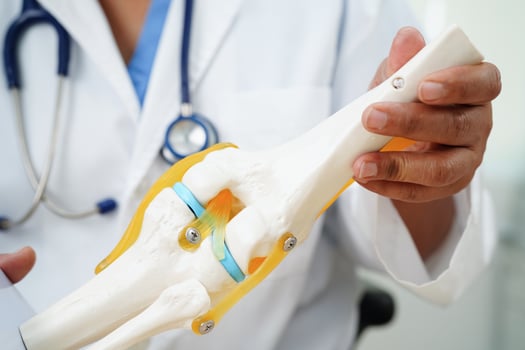 Knee osteoarthritis, Doctor showing model knee joint orthopedic. photo
