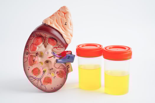 Urinalysis, Kidney and urine cup for check health examination in laboratory. photo