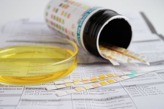 Urinalysis, urine cup with reagent strip pH paper test and comparison chart in laboratory. photo