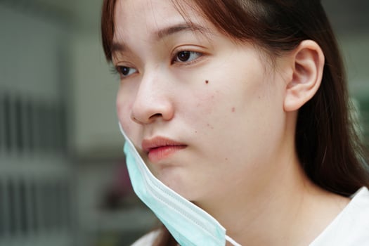 Acne pimple and scar on skin face, disorders of sebaceous glands, teenage girl skincare beauty problem. photo