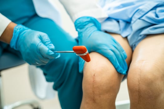 Asian doctor use hammer knock senior woman patient to check knee reflex, nerve and muscle in hospital. photo