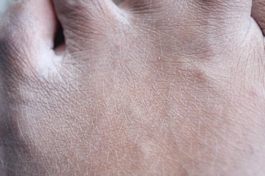 Closeup view of dry human skin . photo