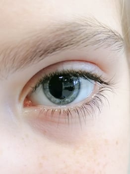 children's eye with dilated pupils photo