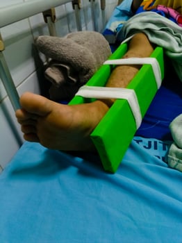 Asian man with broken leg at hospital, a leg bandaged with wood in hospital photo