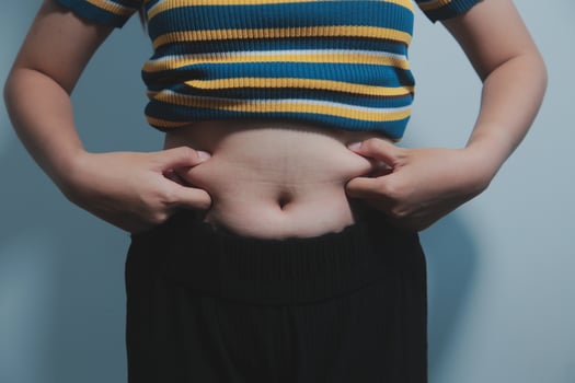 Women body fat belly. Obese woman hand holding excessive belly fat. diet lifestyle concept to reduce belly and shape up healthy stomach muscle. photo