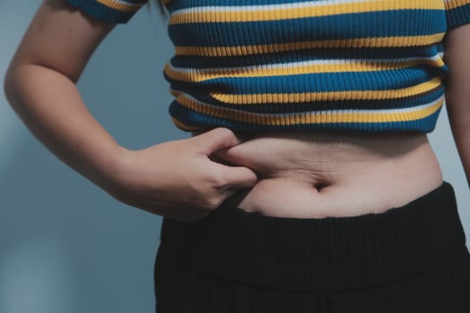 Women body fat belly. Obese woman hand holding excessive belly fat. diet lifestyle concept to reduce belly and shape up healthy stomach muscle. photo
