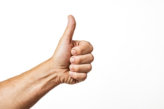 Hand giving thumbs up sign photo
