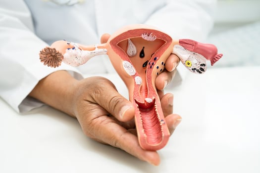 Uterus, doctor with anatomy model for study diagnosis and treatment in hospital. photo