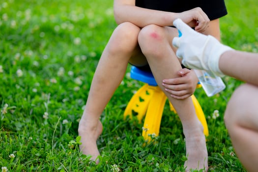 A child injured his knee while playing. Close-up of a wound on a child's knee. The mother examines the child's knee and sprays an antiseptic spray photo
