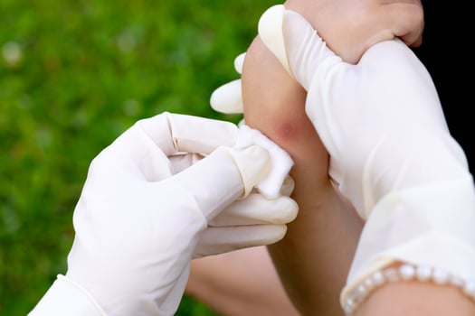 close-up photo of a mother applying cream to her child's hand after an insect, mosquito or bee bite in the summer in the yard