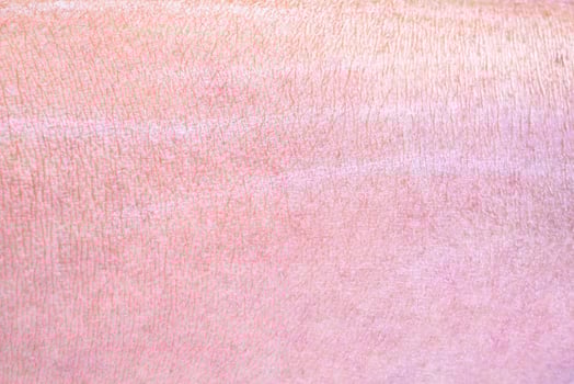 dry and dehydrated human skin texture background photo