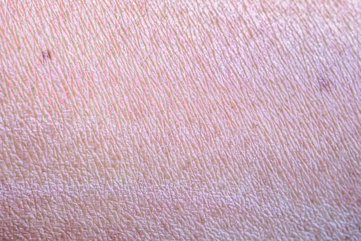 dry and dehydrated human skin texture background photo
