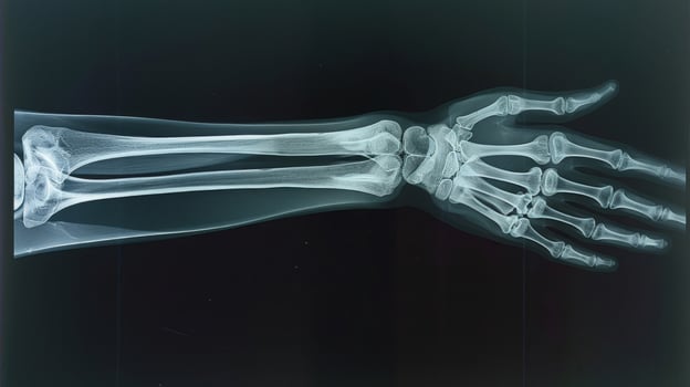 X-ray image of a human forearm displaying detailed bone structure, including radius and ulna. Concept of medical imaging, bone anatomy, orthopedic analysis, and healthcare diagnostics photo