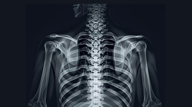 X-ray showing human thoracic skeleton and rib cage. Concept of medical imaging, bones structure, healthcare diagnostics, skeletal anatomy photo